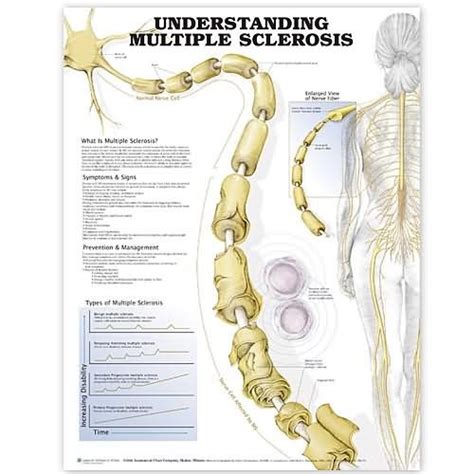 A review of available treatment options. Multiple Sclerosis Poster | MS Anatomical Chart Company