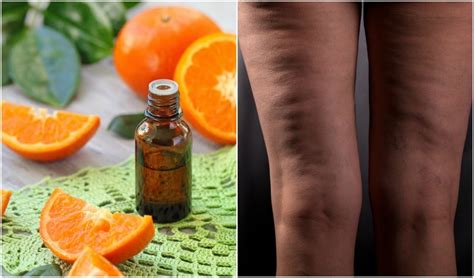 15 Best Essential Oils For Dissolving Cellulite And How To Use Them