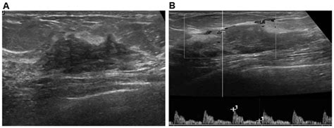 Diagnostic Evaluations Of Ultrasound And Magnetic Resonance Imaging In