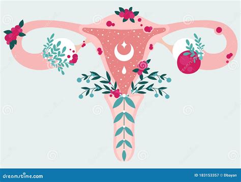 Endometrioma Endometrial Cyst Cartoon Vector 99957717