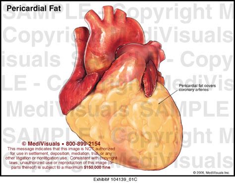 Medivisuals Pericardial Fat Medical Illustration