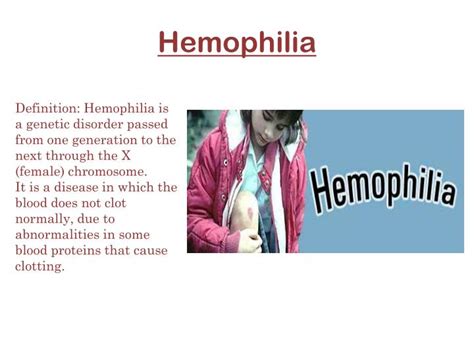 Ppt Hemophilia Powerpoint Presentation Id2136951