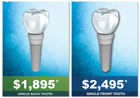 One Stop Implants Southern California Dental Implants Complete