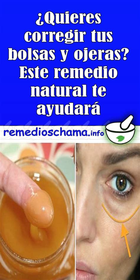 ¿quieres corregir tus bolsas y ojeras este remedio natural te ayudará bolsas de ojos