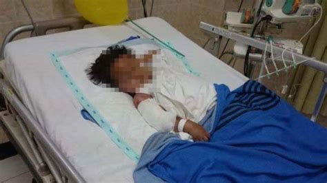 Bocah 10 Tahun Disiram Ibu Kandung Pakai Air Panas Dijambak Hingga