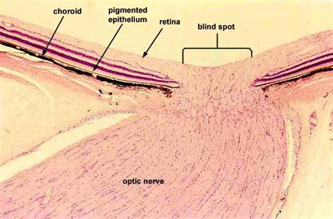 Optic Nerve Anatomía Del Ojo Histología Anatomía