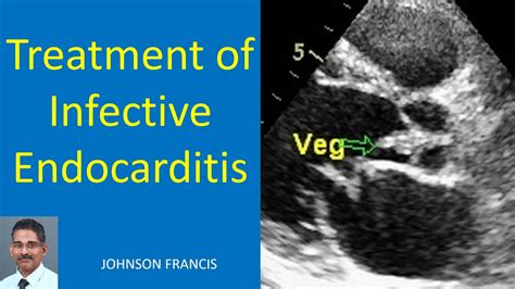 Treatment Of Infective Endocarditis Youtube