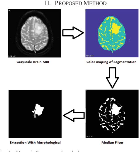 An Effective MRI Brain Image Segmentation Using Joint Clustering K