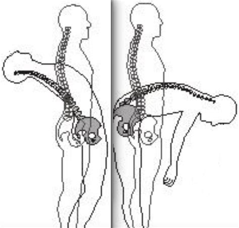 Spinal Flexion Extension Krumur Clinic