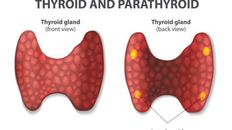 Thyroid And Parathyroid Glands Pathophysiology Nursin