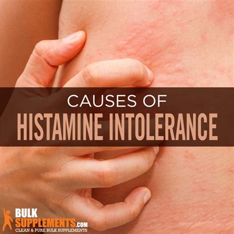 Histamine Intolerance Signs Causes And Treatment