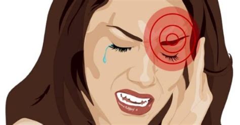 The Stages Of A Migraine And How To Deal With Them Headache Behind