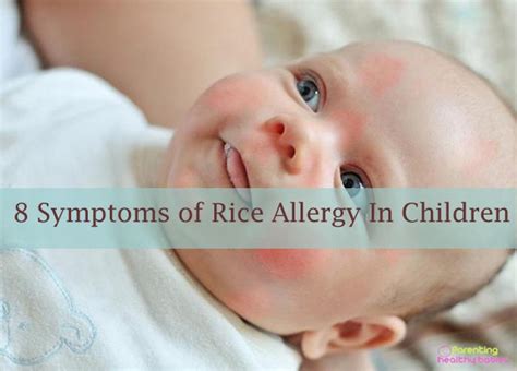 8 Symptoms Of Rice Allergy In Children