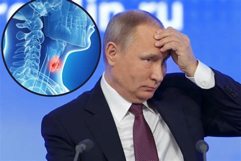 Putin Mia Raka Tarczycy A Leczenie Wywo A O Urojenia Sprawd Jakie S Objawy Raka Tarczycy I