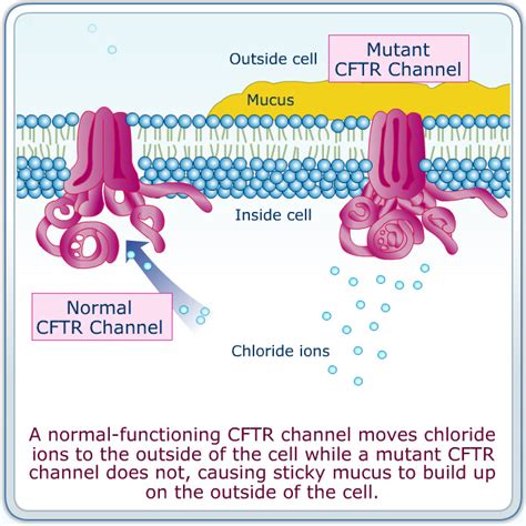 Cyfb Cystic Fibrosis