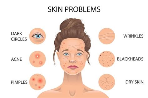 Face Skin Problems Akarshan Skin Laser And Hair Clinic