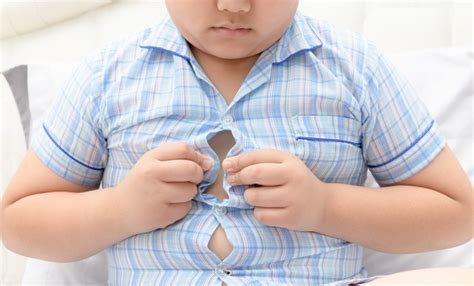 La prevención de la obesidad desde la infancia Cirugia y Obesidad