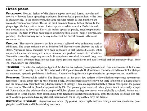 Common Oral Lesions By Kelly Hendricks Issuu