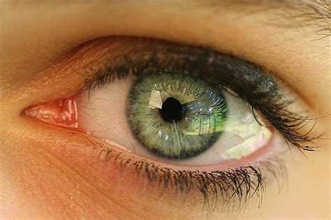¿qué es el síndrome del ojo seco