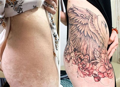 This Vietnamese Tattoo Artist Helps People Regain
