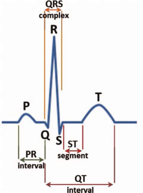 Ecg Waveform With The Characteristic P Wave Qrs Complex T And U Waves