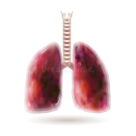 The Respiratory System Of A Man Showing Disease Stock Illustration