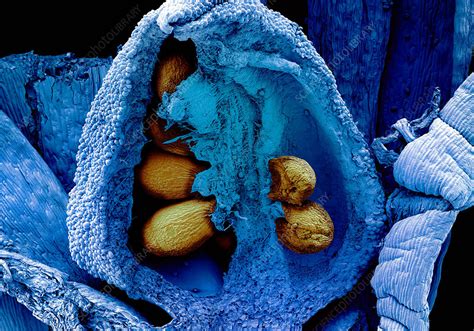 A normal embryo sac and embryo progression are prerequisite to get satisfactory yield  21 . Ovule with Embryo Sac, SEM - Stock Image - C043/7353 ...