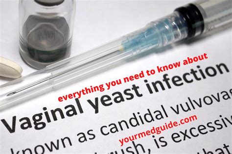 What Is A Vaginal Yeast Infection Causes Symptoms Treatment