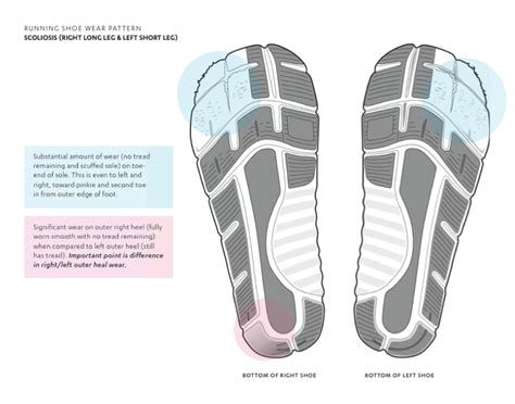 Overpronation Shoe Wear Pattern
