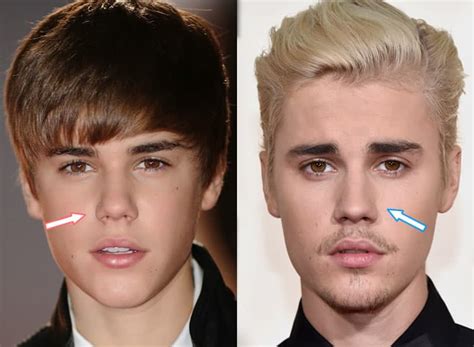 Justin Bieber Before And After Transformation 2018