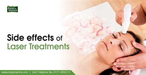 Should You Have Laser Treatment For Acne What Are The Side Effects