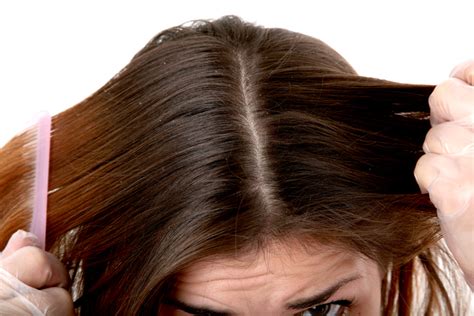 6 Healthy Scalp Tips For Better Hair