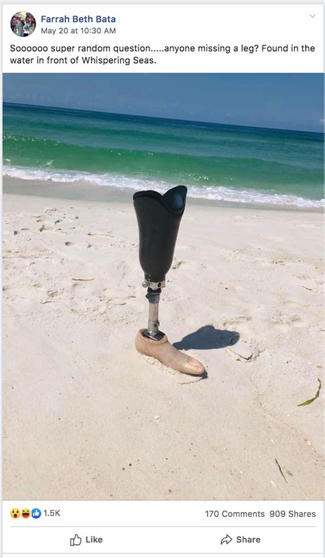 Women Reunite Prosthetic Leg Found At Fla Beach With Owner