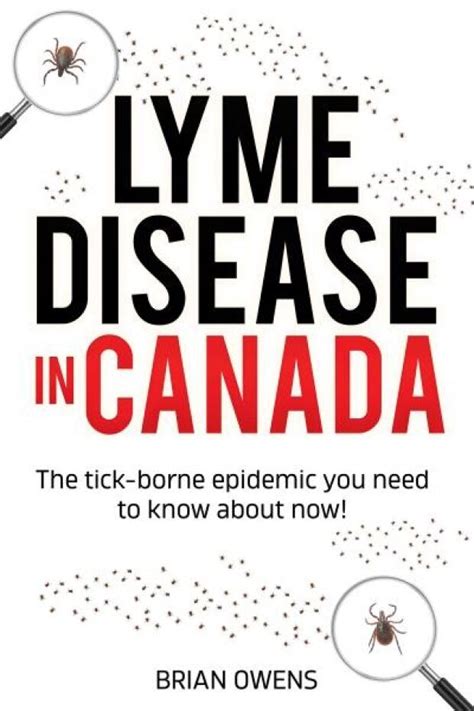 Author Of New Book On Lyme Disease Says There Are Lessons In Covid 19