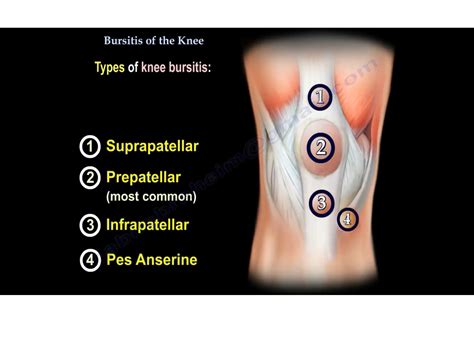 Knee Bursitis Anatomy