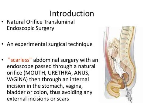 Natural Orifice Transluminal Endoscopic Surgery