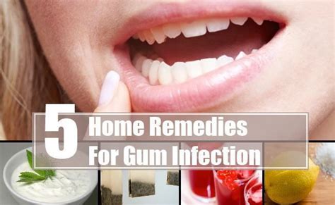 5 Home Remedies For Gum Infections That Really Works Gum Disease Cure