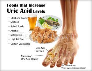 Knowing how to treat gout naturally is much more than just what is on this uric. Homeopathic Treatment of Gout ( Increased Uric Acid in blood )