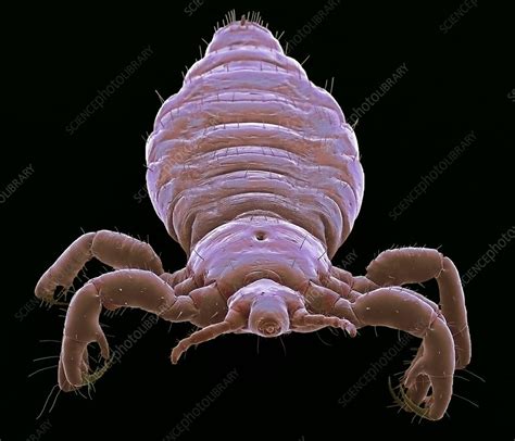 Head Louse Sem Stock Image C0550656 Science Photo Library
