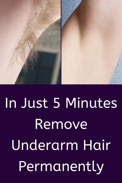 Remove Underarms Hair Permanently In Just 5 Minutes Underarm Hair Remove Armpit Hair How To