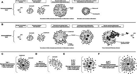 Granuloma Formation Schematics Of Lesion Structure At Each Stage Of