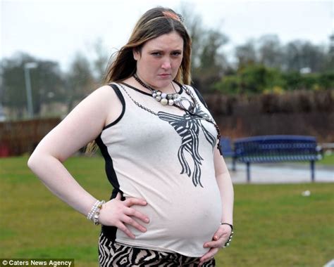 The Woman Whos Looked Eight Months Pregnant For The Last 15 Years Due