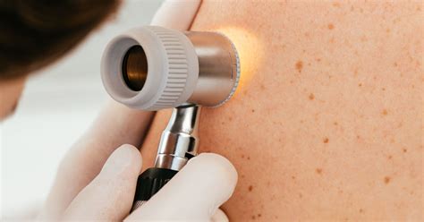 Best Skin Cancer Treatment Doctors And Hospitals In India