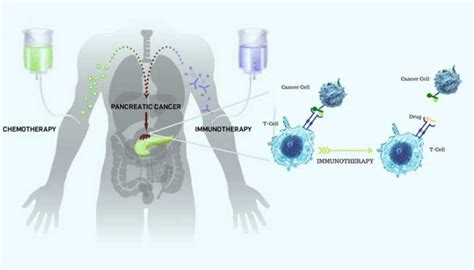 Immunotherapy Pan Cancer Tmb Positive Bioscience