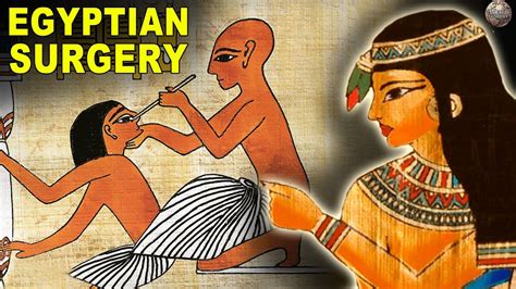 What Surgery Was Like In Ancient Egypt Go It