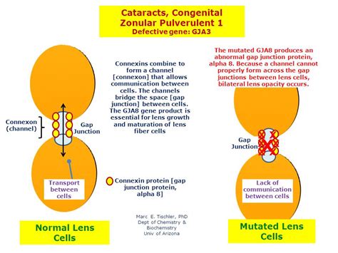 Cataracts Congenital Zonular Pulverulent 1 Hereditary Ocular Diseases