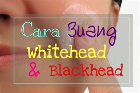 Cara mencegah dan hilangkan jeragat dan tompok gelap pada wajah. 8 Cara Hilangkan Blackhead dan Whitehead | Vitamin Cerdik ...