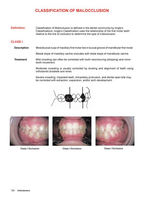 IHCD 13 IHCD 124 Orthodontics ClaSSIfICaTION Of MalOCCluSION ClaSS