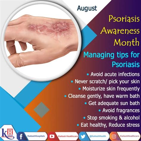 Psoriasis Is Manageable And Treatable If Diagnosed Early Know The Tips