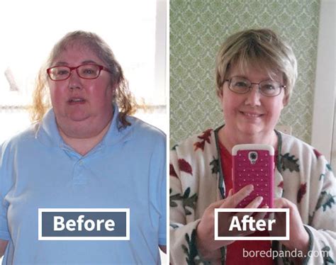 50 Amazing Before And After Pics Reveal How Weight Loss Affects Your Face Health Upward